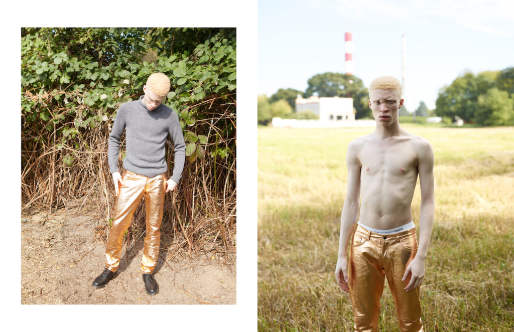 SAMESAME agency Wunsche&Samsel editorial exklusiv Shaun Ross